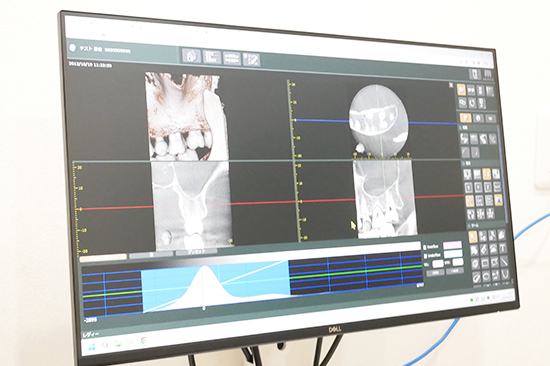 説明用モニター